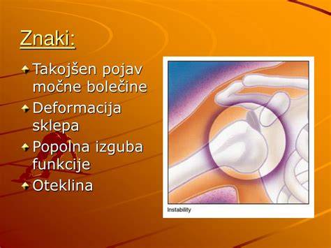 Vnetje in zgradba sklepa