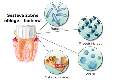zobna sklenina in zobne obloge shema